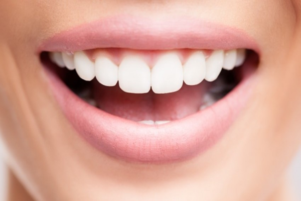 مراحل انجام کامپوزیت دندان