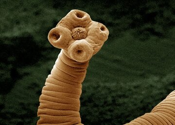 چرا نباید از نابودی انگلها خوشحال شویم؟ چرا نباید از نابودی انگلها خوشحال شویم؟