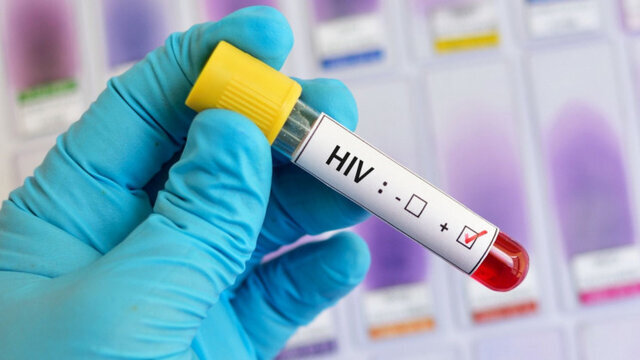 کشف راهی جدید برای درمان ایدز