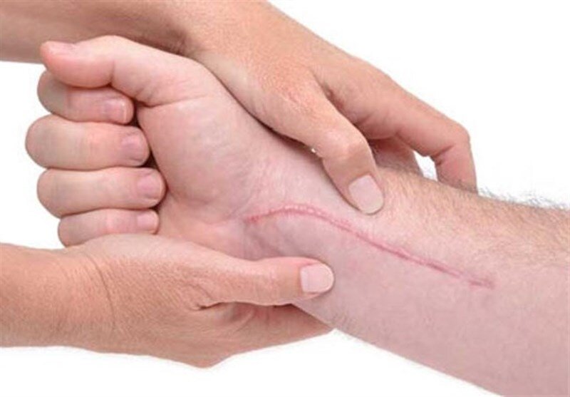 ۹ فایده شگفتانگیز گلاب برای سلامتی