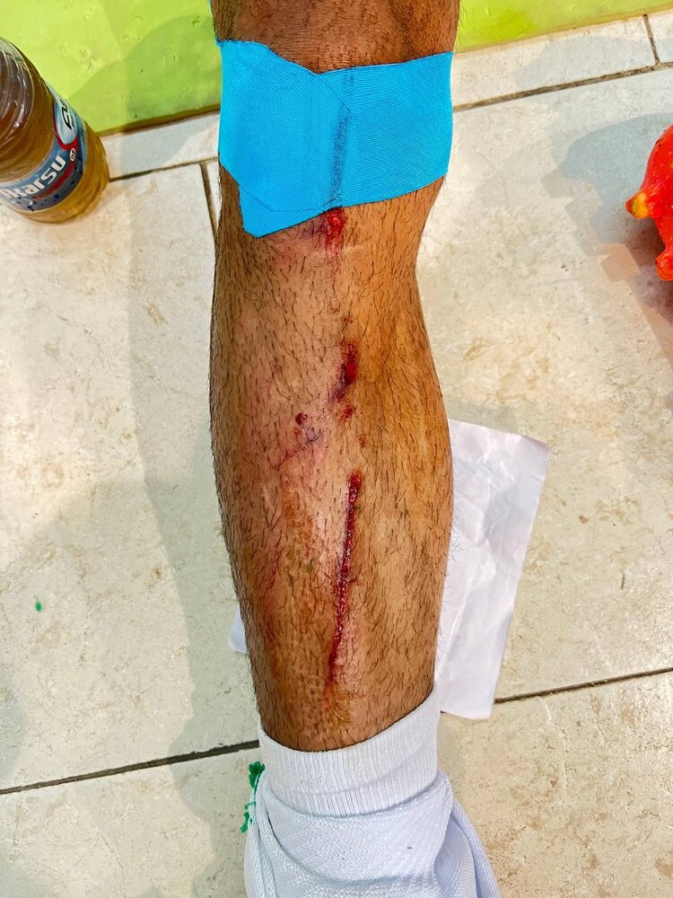 عکس| بلایی که بیرانوند سر بازیکن استقلالی آورد