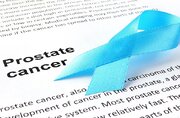 عوامل کاهش خطر ابتلا به شایع‌ترین سرطان مردان