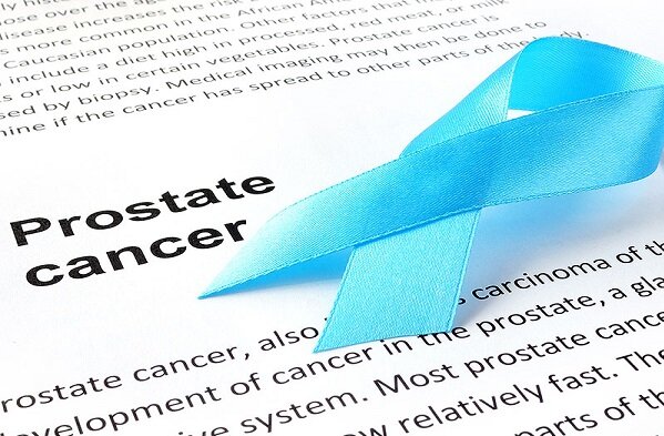 - عوامل کاهش خطر ابتلا به شایع‌ترین سرطان مردان