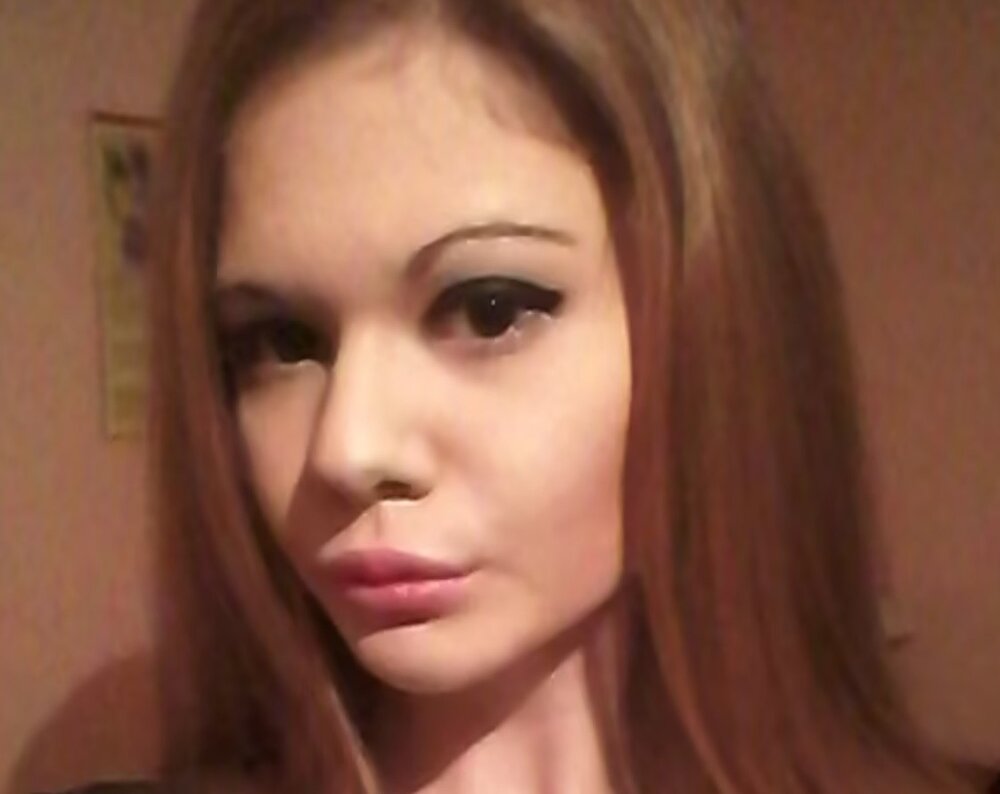 عکس| وحشت نکنید! این زن با تزریق ژل به لبهایش میخواهد رکورد گینس را بزند