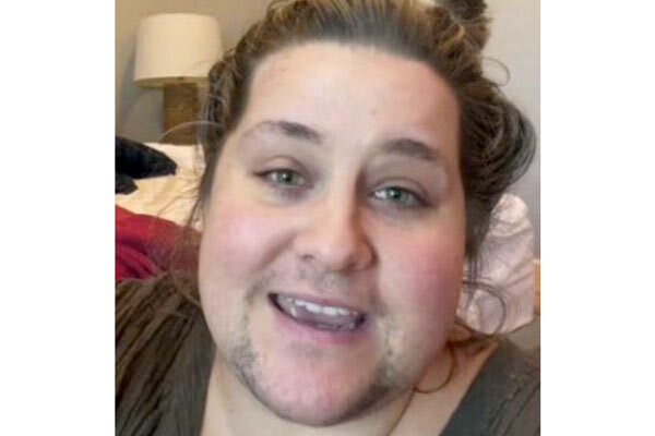 عکس| زنی که هر روز باید ریشهای خود را بتراشد