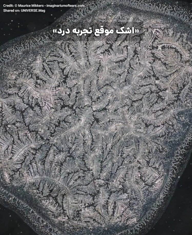 تفاوت عجیب میکروسکوپی اشک بریدن پیاز و شکستهای عاطفی/ عکس