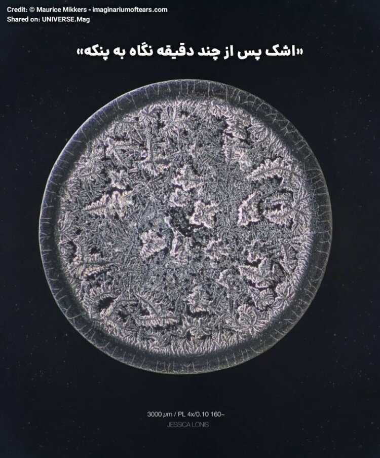 تفاوت عجیب میکروسکوپی اشک بریدن پیاز و شکستهای عاطفی/ عکس