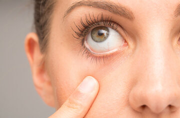 علائم بیماری خشکی چشم را بشناسید / بهترین راه برای درمان