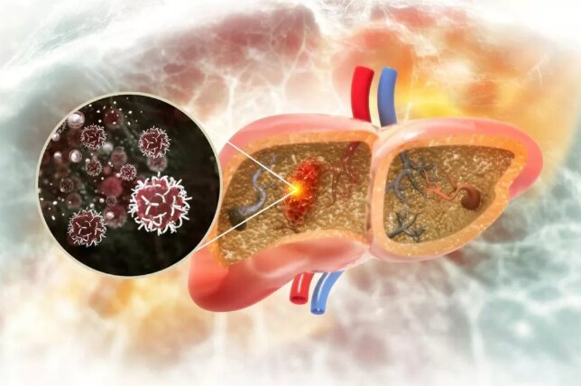 هوش مصنوعی راه درمان یک سرطان را پیدا کرد