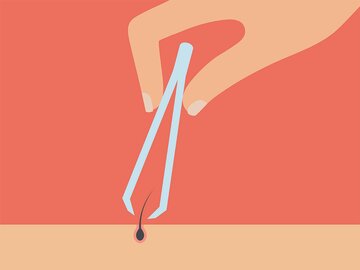 سه باور غلط درباره موهای زائد سه باور غلط درباره موهای زائد