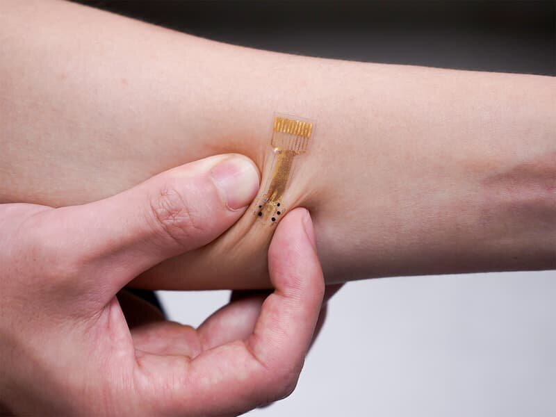 چسب شفابخش زخمهای مزمن را درمان میکند/ عکس