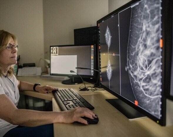 دقت حیرت‌انگیز هوش مصنوعی در تشخیص سرطان سینه/ عکس