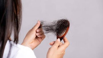 جلوگیری و درمان ریزش مو با این دمنوش‌های گیاهی