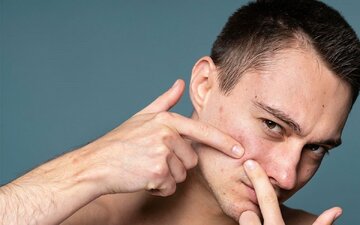 این خوراکیها را بخورید جوش میزنید