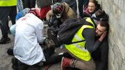 ببینید | لحظه هولناک قطع شدن دست یک معترض در فرانسه!