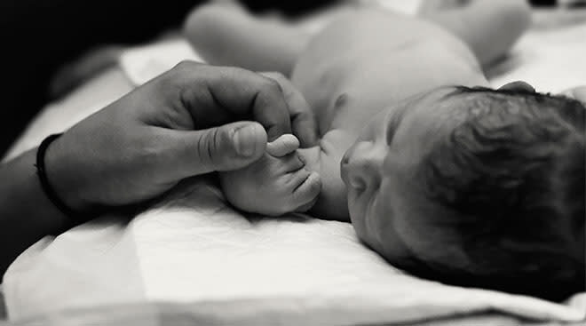 عکس | تولد نوزاد دو سر در مکزیک!