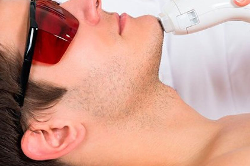 ببینید | آیا لیزرهای جوان‌ساز، لک‌های صورت را محو می‌کنند؟