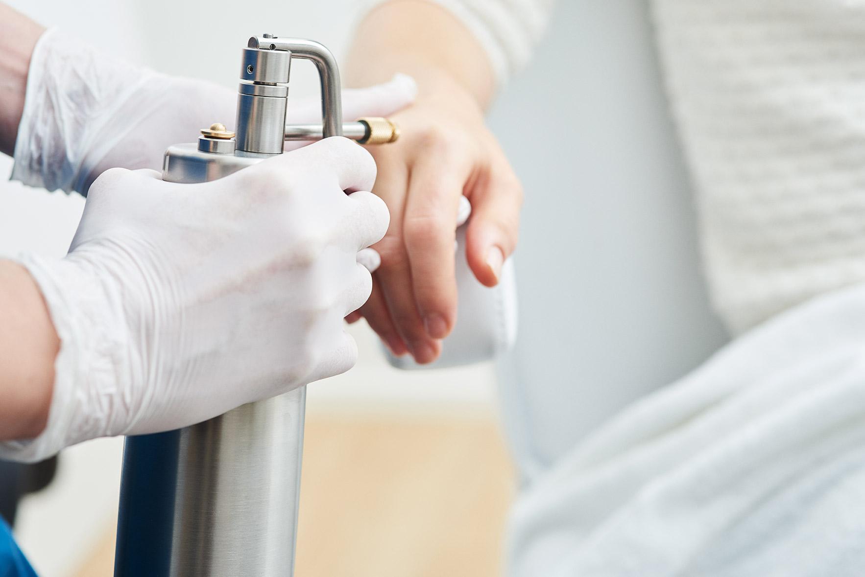 کرایو اسپری و کرایو پن برای درمان زگیل