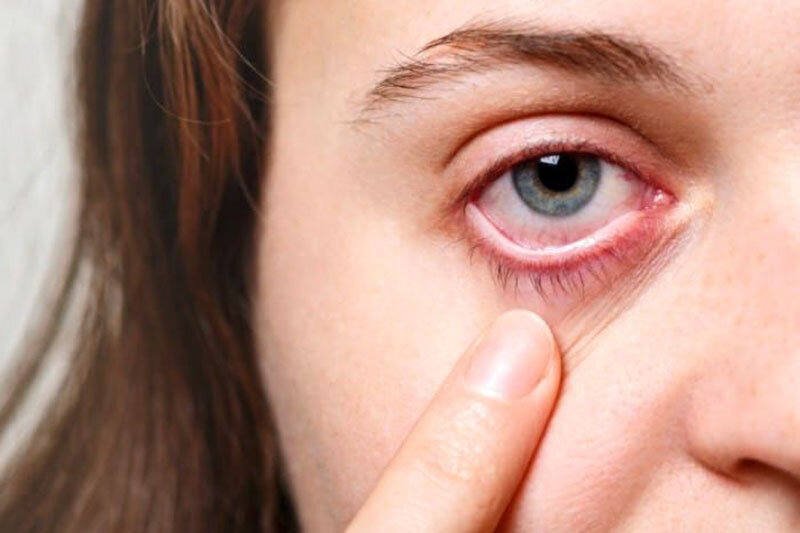بیماری‌ها چشم که مسبب آن آلودگی هواست