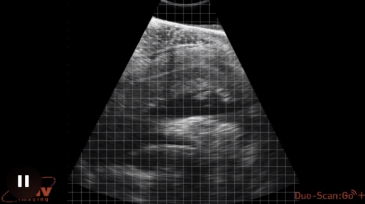 یافتههای ترسناک سونوگرافی یک ماهی/ عکس
