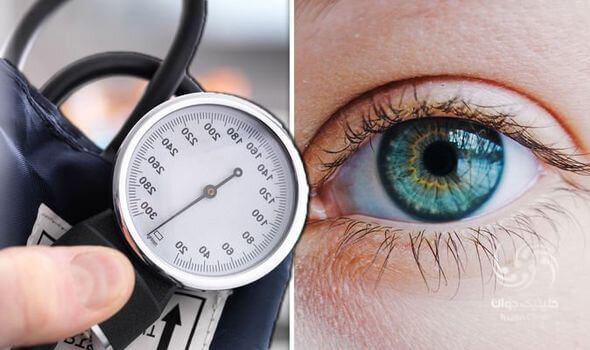 ببینید | فشار خون بالا چطور سلامت چشم‌ها را تهدید می‌کند؟