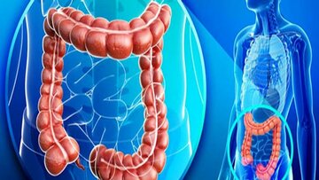 اینفوگرافیک | راهکارهایی مفید برای بهبود سلامت روده