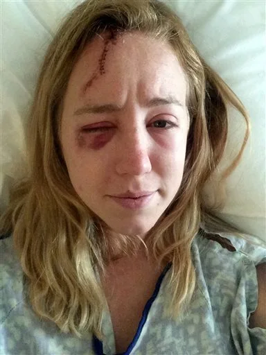 اصابت رعد و برق حس تازهای را در این زن بیدار کرد!/ عکس