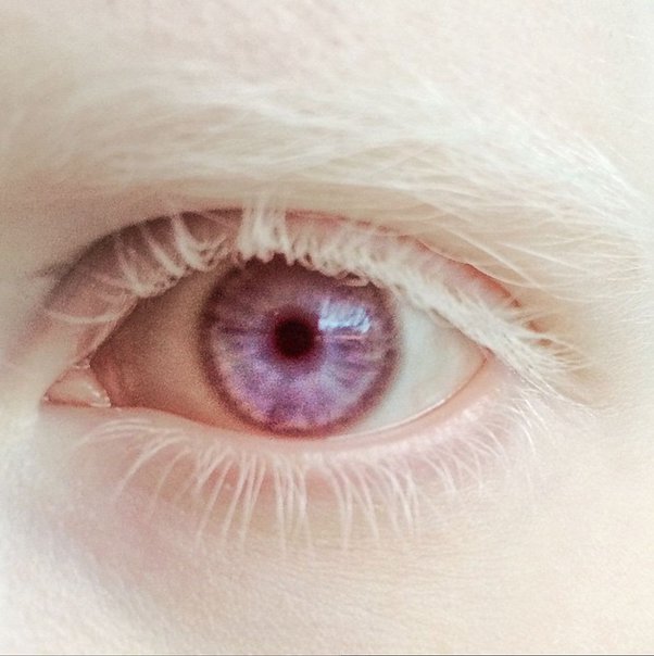 نادرترین رنگ چشم در جهان/ چرا رنگ چشم برخی بنفش است؟ / عکس