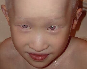 عکس | «چشمقرمزها» افسانه نیستند! عکس | «چشمقرمزها» افسانه نیستند!