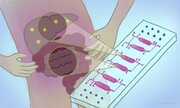 راه حل ژاپنی برای درمان کبد چرب