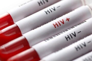 چند ایرانی به HIV مبتلا هستند؟/ راه‌های انتقال بیماری