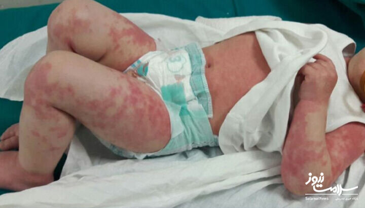 ۱۲ علامت هشدار دهنده بیماری قلبی که روی پوست ظاهر میشود