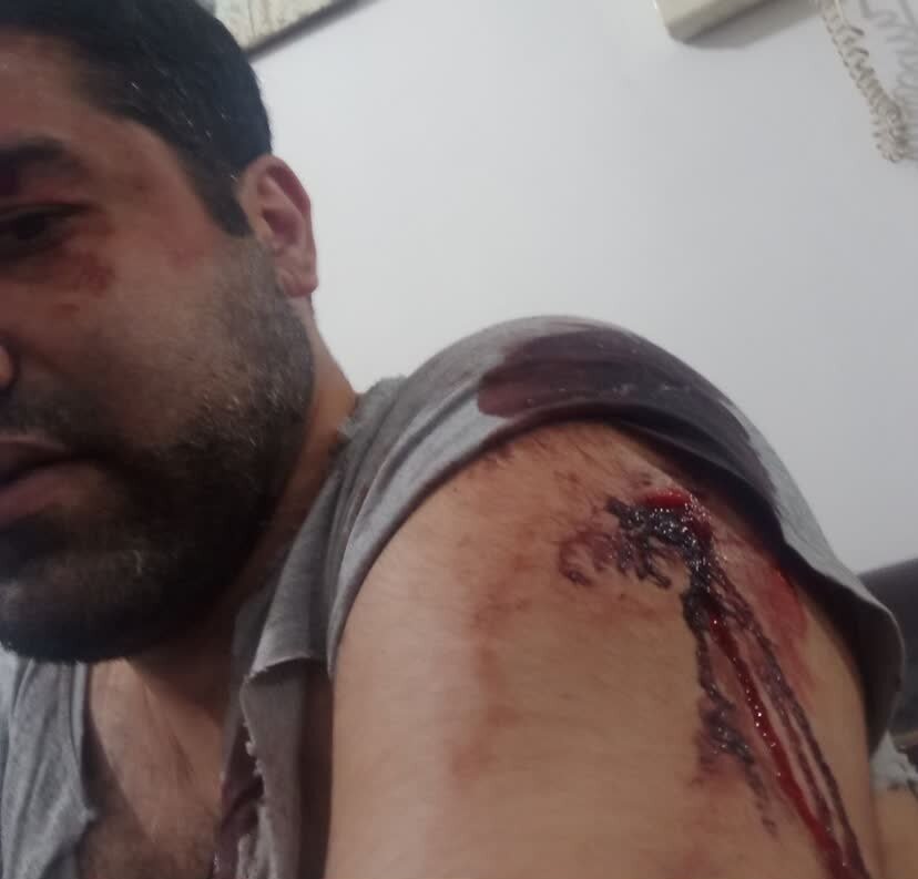 جزئیات حمله به یک استاد دانشگاه در جریان تذکر لسانی/ عکس