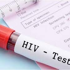 شناسایی ۱۲۶۹ فرد HIV مثبت در خوزستان/ ۹۵ درصد تحت مراقبت یا درمان‌ هستند