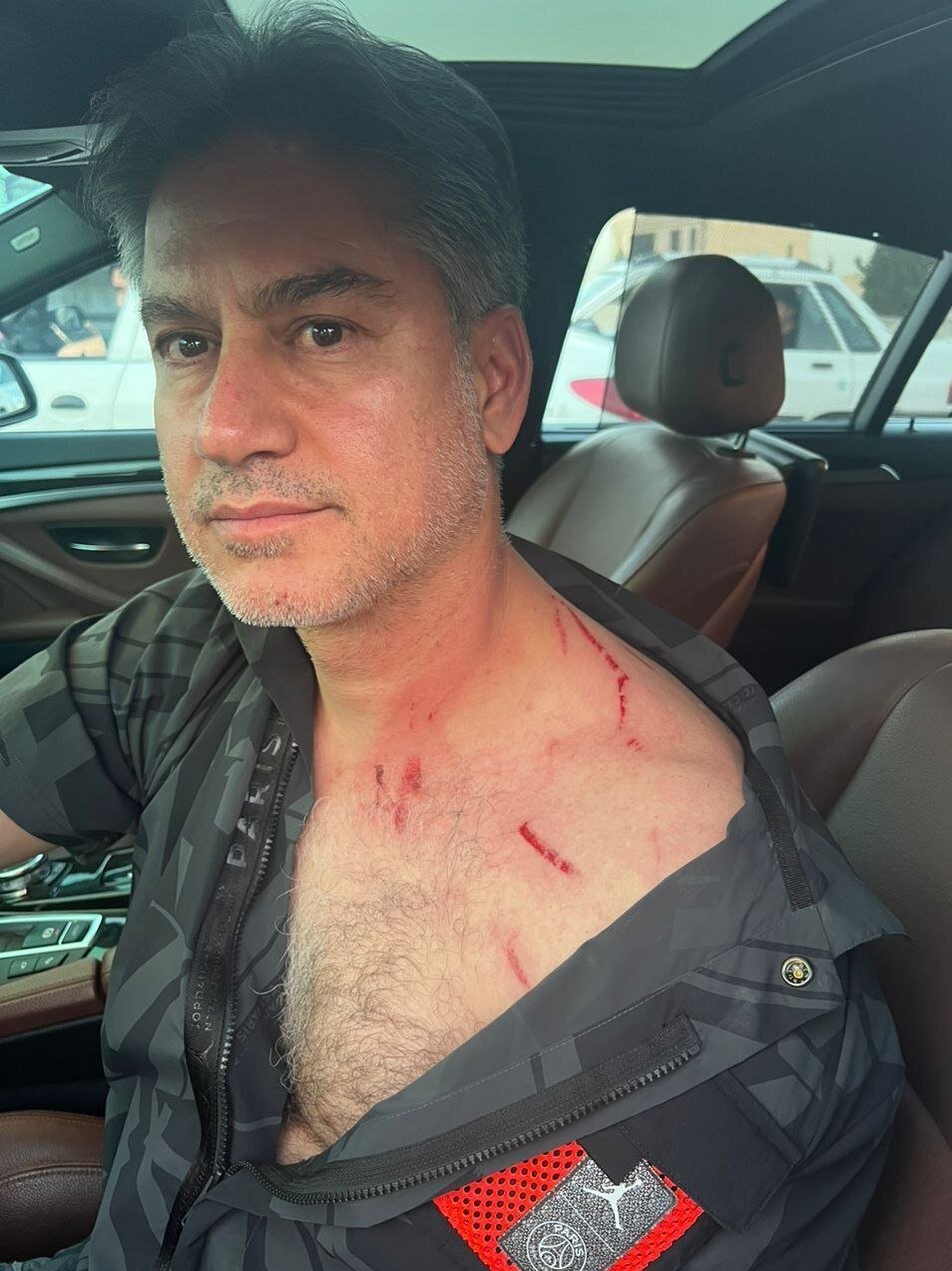 عکس | وحشت وسط اتوبان مدرس؛ حمله به مطهری و گردن خونآلود!