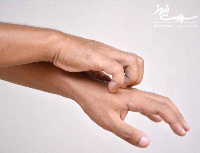 علائم هشدار دهنده «بیماری کلیوی» که روی پوست ظاهر میشوند/ این نشانهها را جدی بگیرید