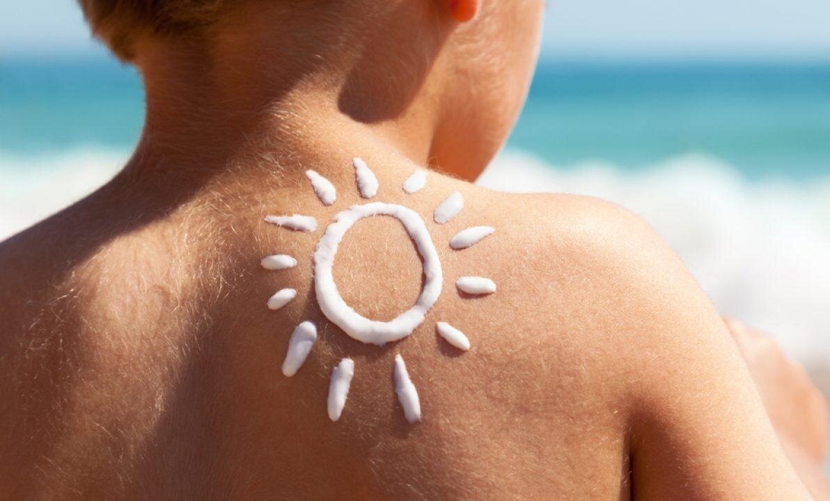 آفتابسوختگی چیست؟ راههای پیشگیری از آن کدامند؟