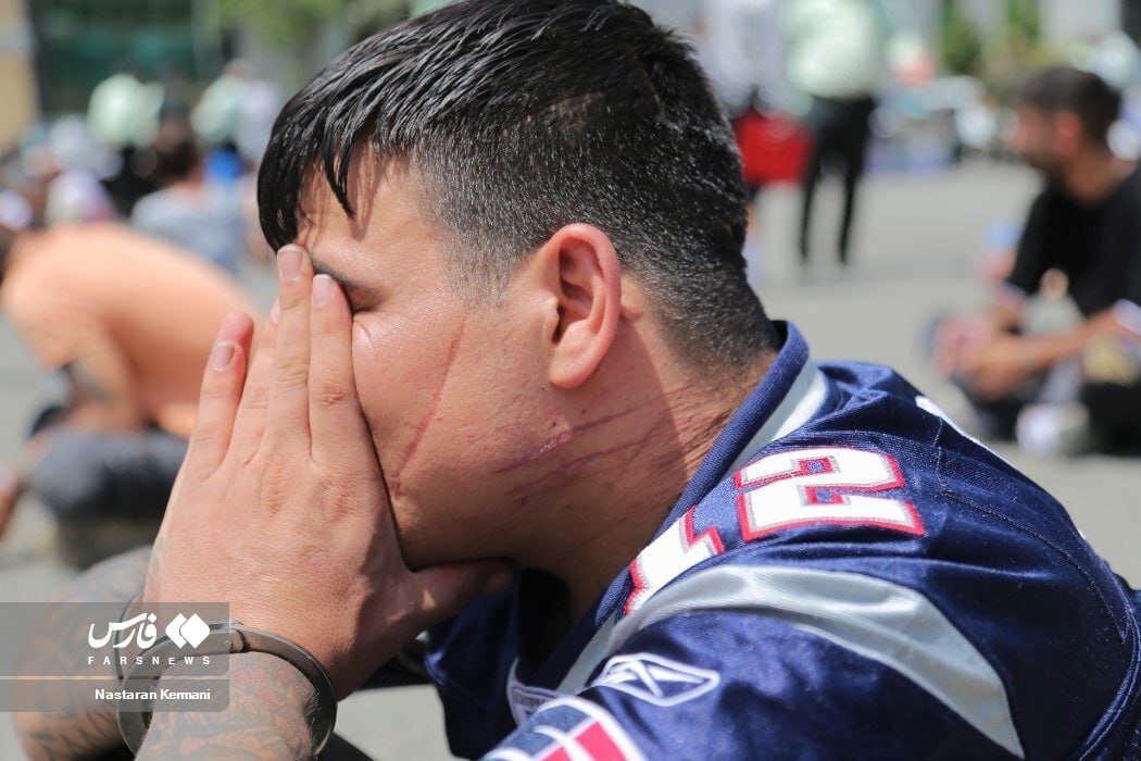 عکس | تصویری عجیب از زخمهای متعدد چاقو و قمه روی صورت خلافکار بازداشتی