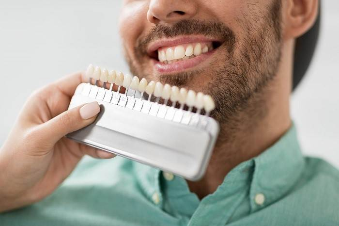انتخاب بهترین روش برای بهبود زیبایی دندان ها