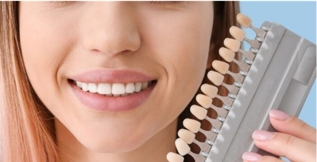 انتخاب بهترین روش برای بهبود زیبایی دندان ها