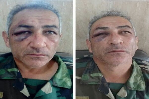 تصاویر ضرب و شتم شدید یک جنگلبان توسط قاچاقچیان چوب/ عکس