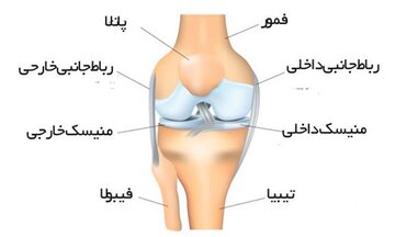 روش درمان گرفتگی رگ پشت زانو چپ