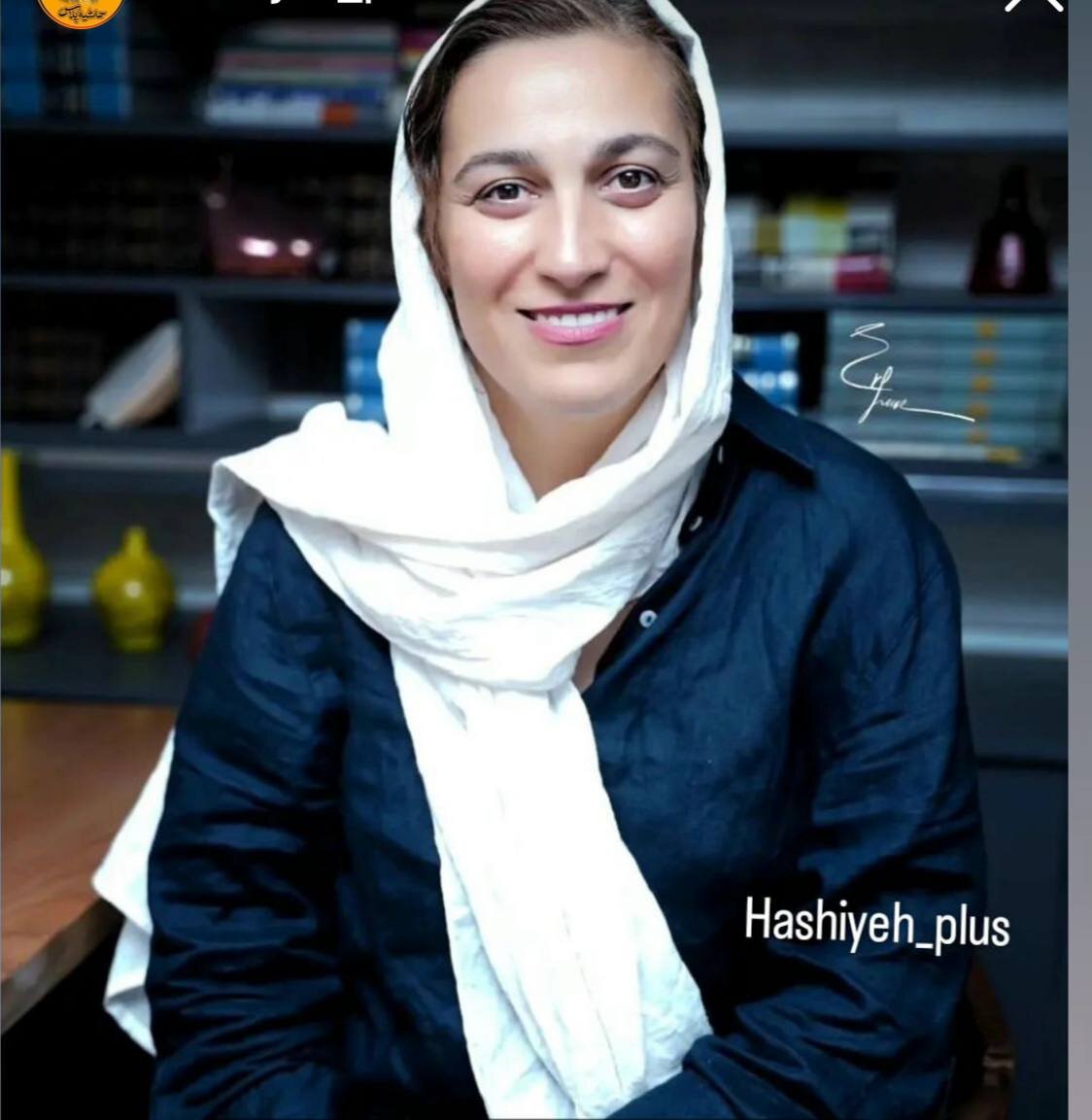 عکس | جدیدترین تصویر از بازیگر معروف سریال شبهای برره