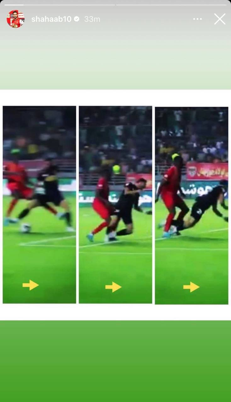 عکس| اعتراض خلاقانه یک پرسپولیسی؛ رونمایی از تصویر کبودی پا و لحظه پنالتی!