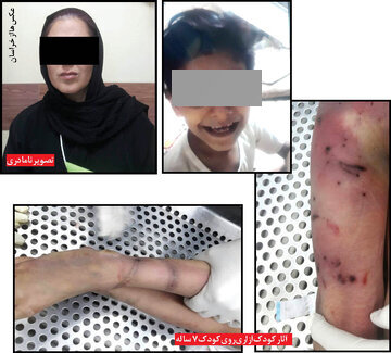 قتل هولناک پسربچه ۷ ساله در شکنجهگاه نامادری/ عکس