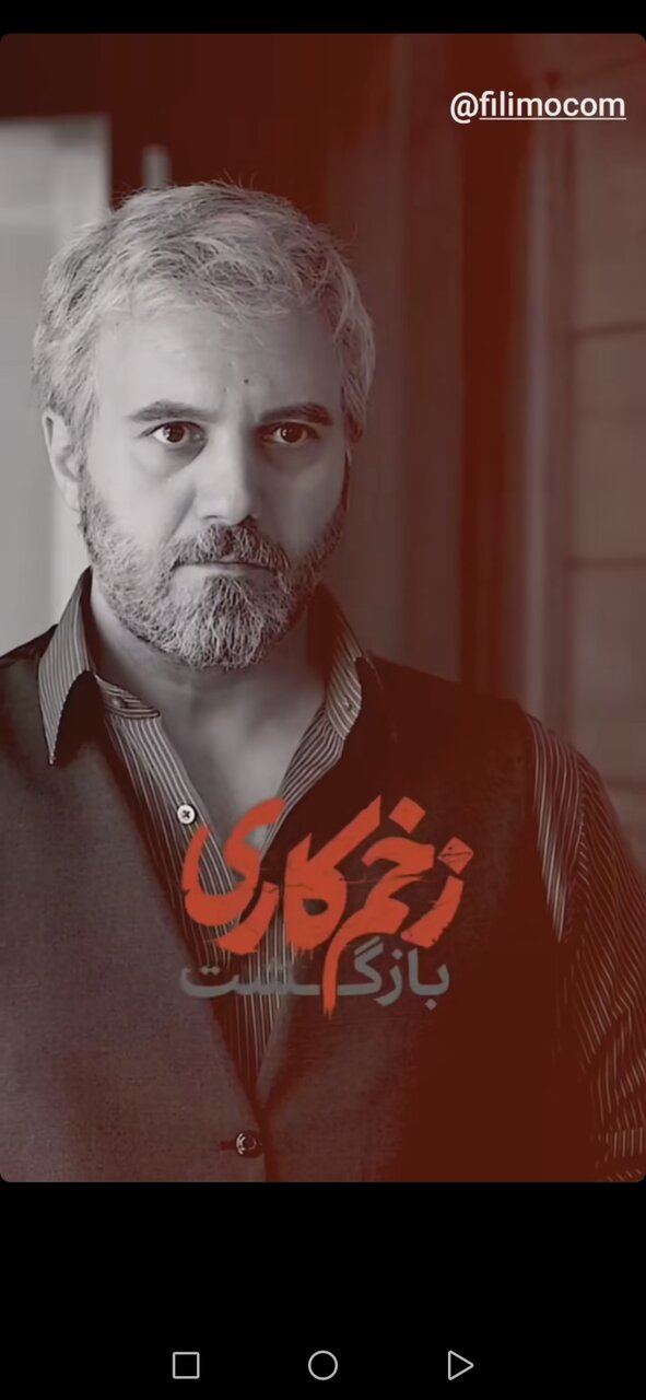 بازیگر زخم کاری از گریم جدیدش رونمایی کرد/ عکس