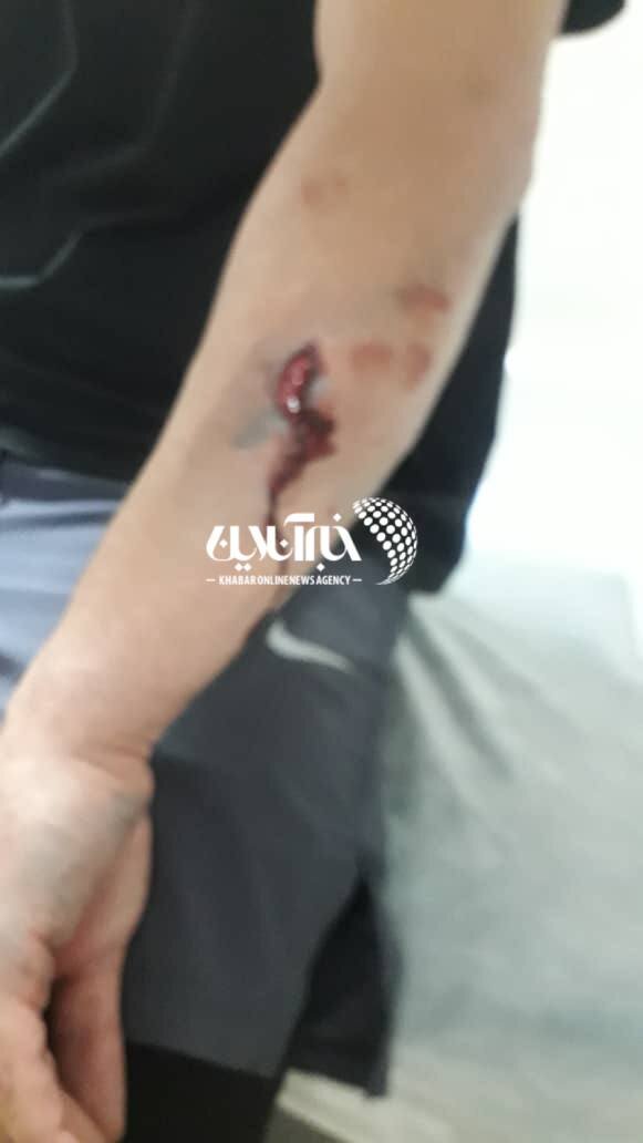 عکس| سارقها به ستاره سابق پرسپولیس حمله کردند/ کار آقای فوتبالیست به بیمارستان کشیده شد