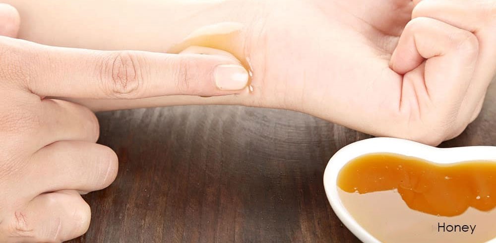 درمان انواع زخم‌ها با پماد عسل