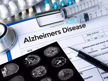 علائم اولیه آلزایمر در کدام قسمت بدن ظاهر می‌شود؟