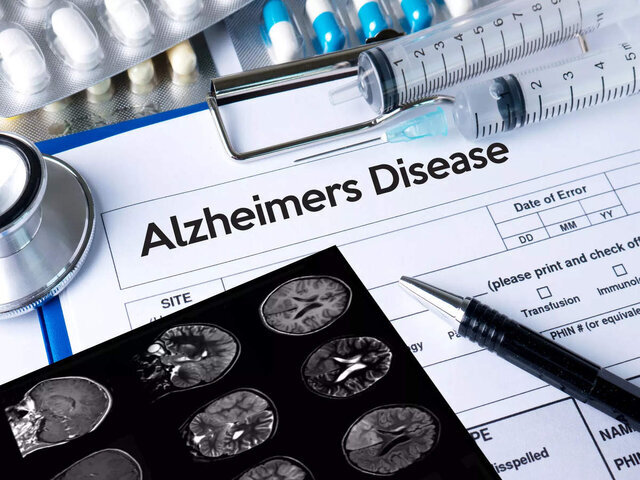 - شناسایی داروی جدید برای آلزایمر